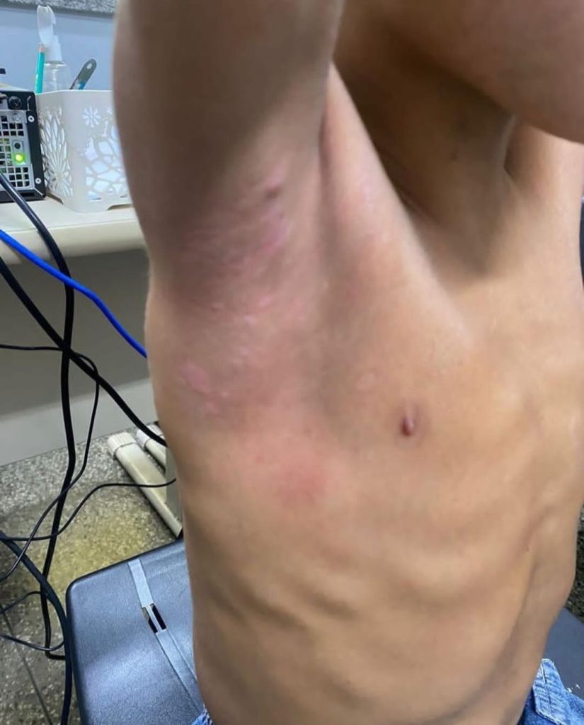 Polícia resgata menino de 9 anos que era torturado pelo pai e madrasta, no bairro Gilberto Mestrinho 3