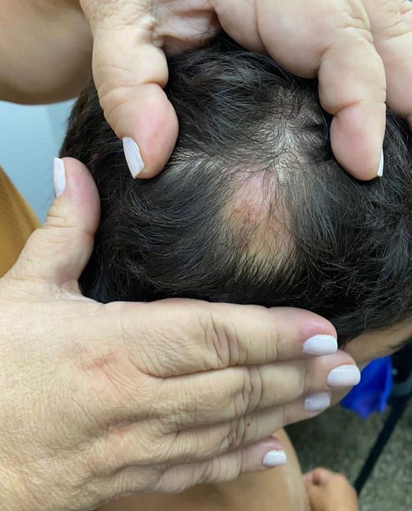 Polícia resgata menino de 9 anos que era torturado pelo pai e madrasta, no bairro Gilberto Mestrinho 5