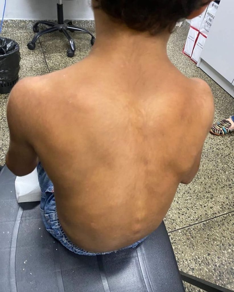 Polícia resgata menino de 9 anos que era torturado pelo pai e madrasta, no bairro Gilberto Mestrinho 7