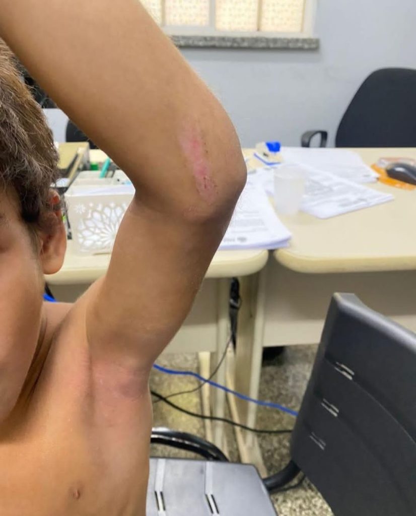 Polícia resgata menino de 9 anos que era torturado pelo pai e madrasta, no bairro Gilberto Mestrinho 6